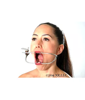 Jennings Dental Mouth Gag