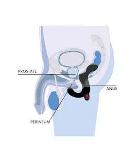 Duke Vibrating Prostate Simulator